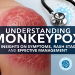 Understanding Monkeypox: Key Insights on Symptoms, Rash Stages, and Effective Management